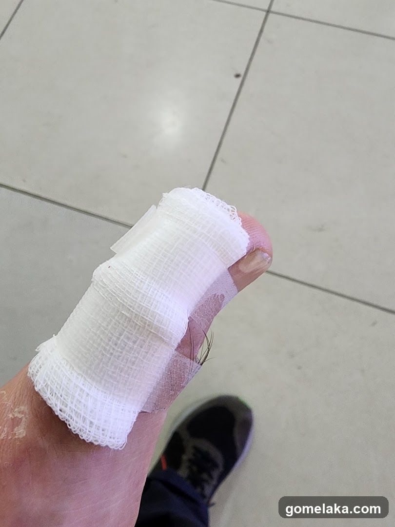 Injured Toe with Bandage