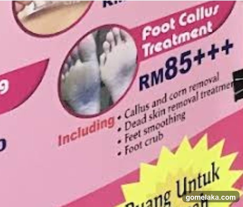 Foot Callus Treatment Advertisement